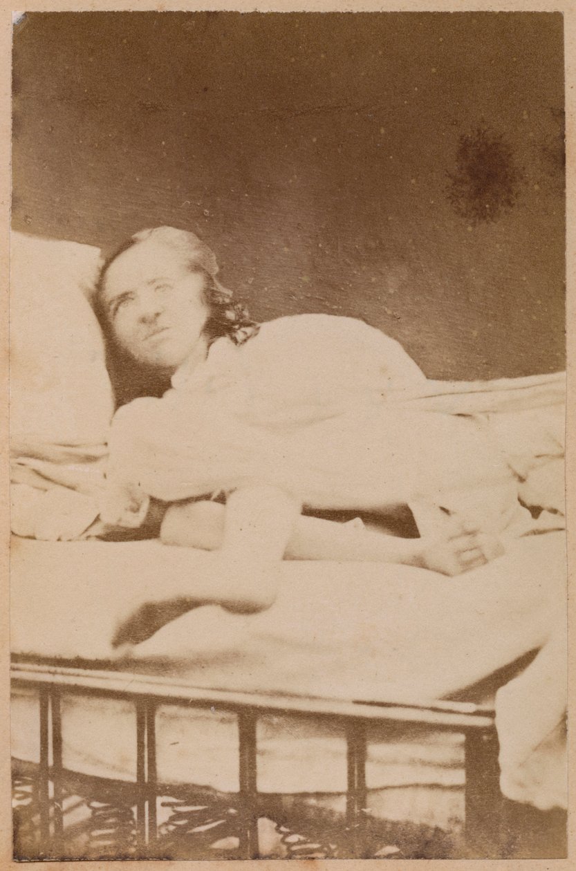 Hysterical epilepsy, contortions, plate XXXVIII from 