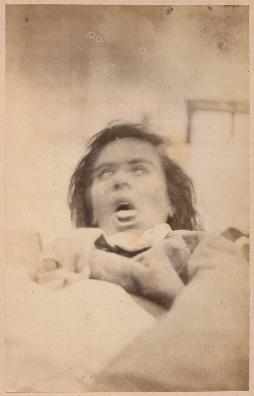 Hysterical epilepsy, hallucinations, anguish, plate XXIX from 