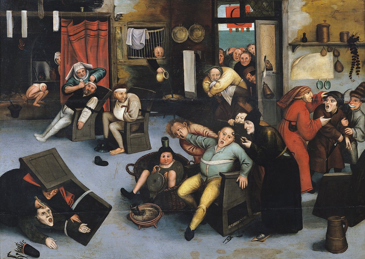Cutting Out the Stone of Madness or an Operation on the Head by Pieter Bruegel the Elder
