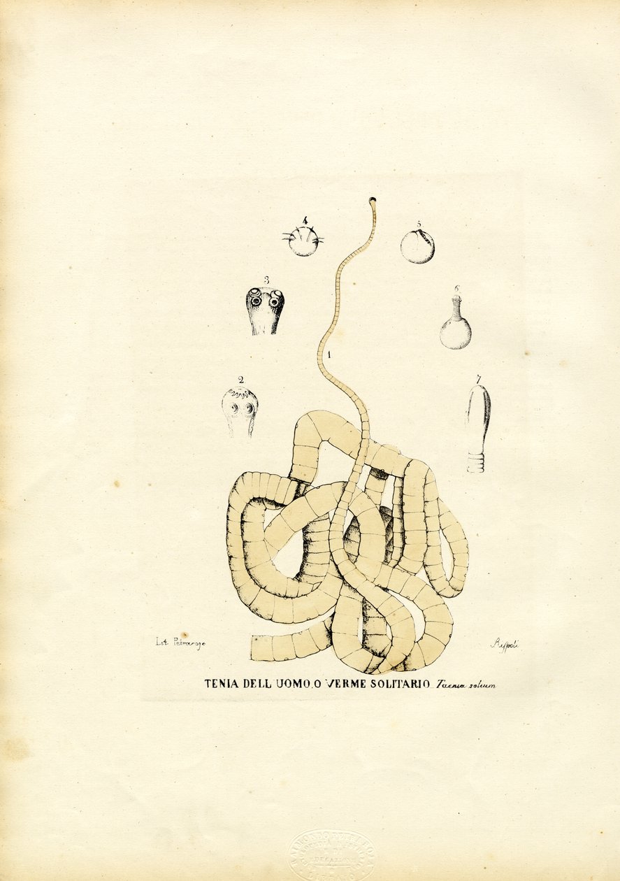 Tape Worm, 1863-79 by Raimundo Petraroja