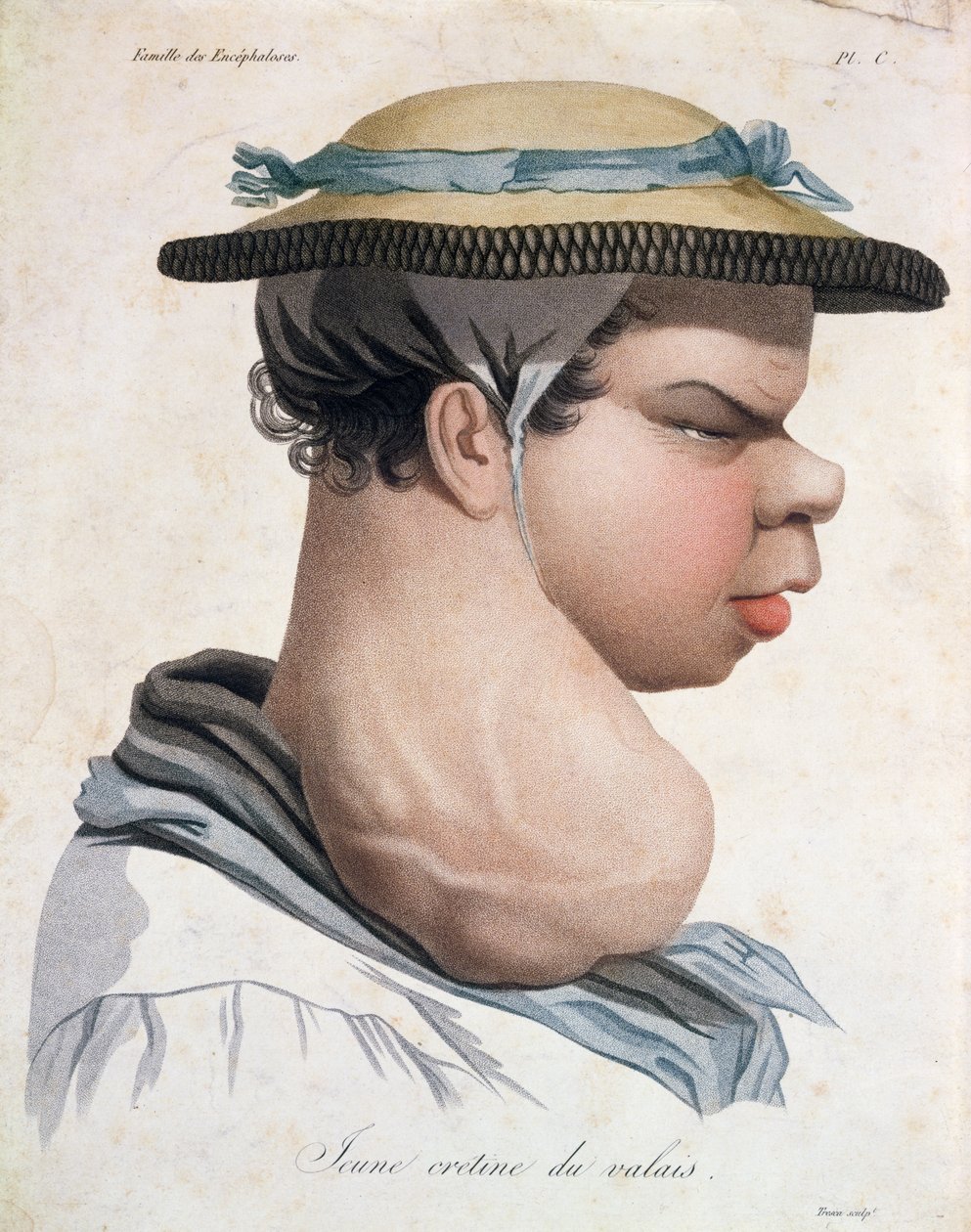 Young Cretin from Valais by Salvadore Tresca