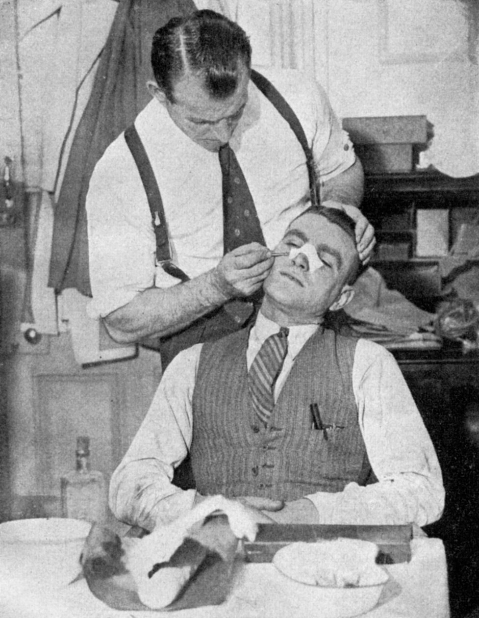 England Captain Eddie Hapgood Receives Treatment for a Broken Nose After a Match with Italy by Topical Press Agency