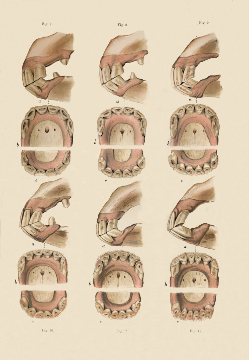 Description of Plate Showing the Age, As Indicated By The Teeth by Unbekannt