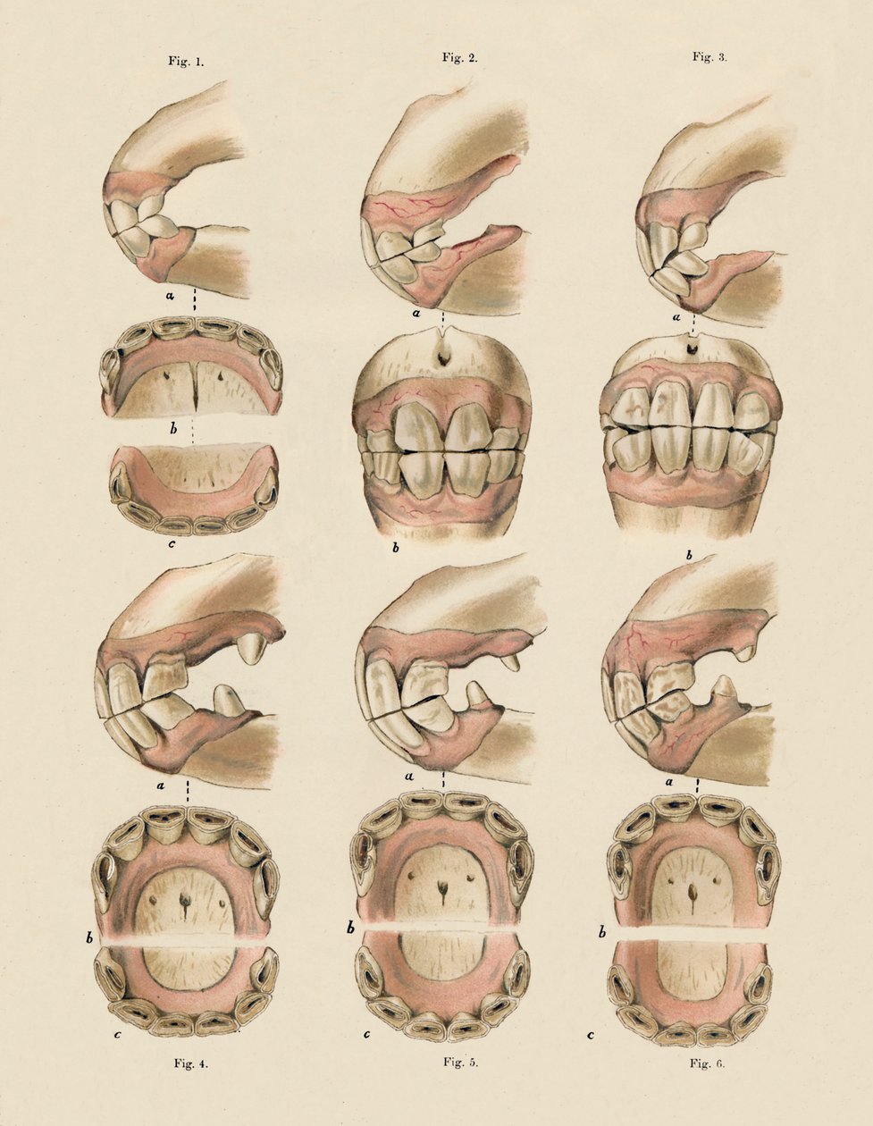Description of Plate Showing the Age, as Indicated by the Teeth by Unbekannt