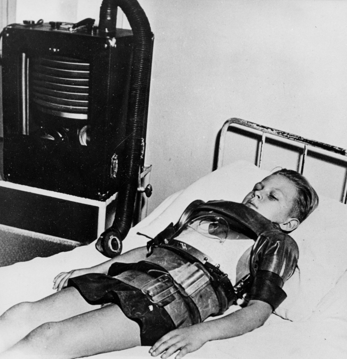 Eleven-Year-Old Boy in an Iron Lung, Beaujon Hospital, Paris by Unbekannt