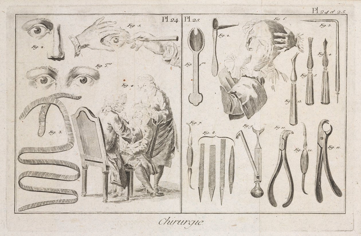 Equipment, Early-Modern Eye Surgery and Surgical Instruments by Unbekannt