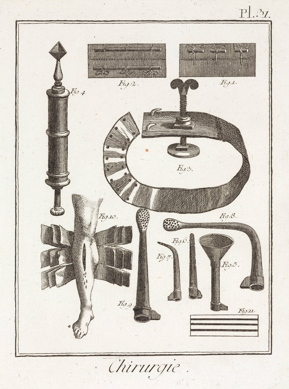 Early-Modern Surgical Devices by Unbekannt