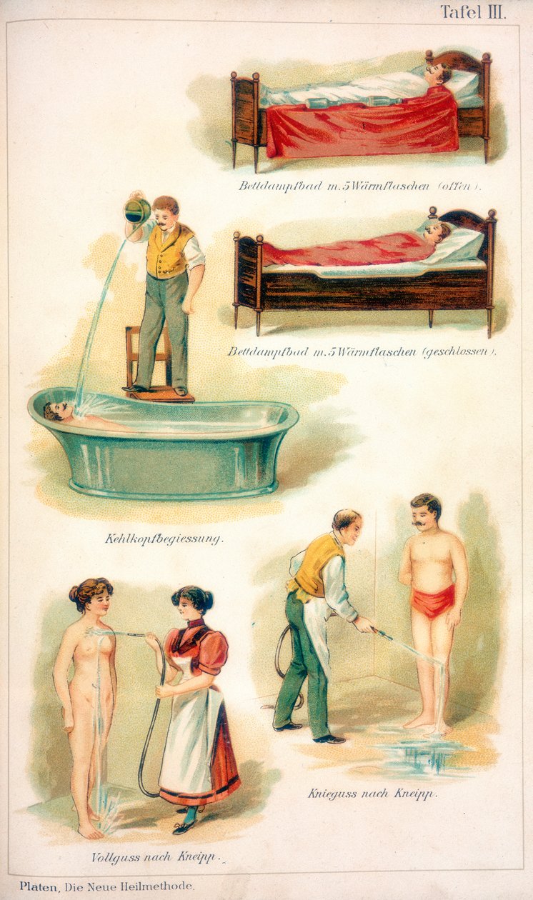 Hydrotherapy treatments by Unbekannt