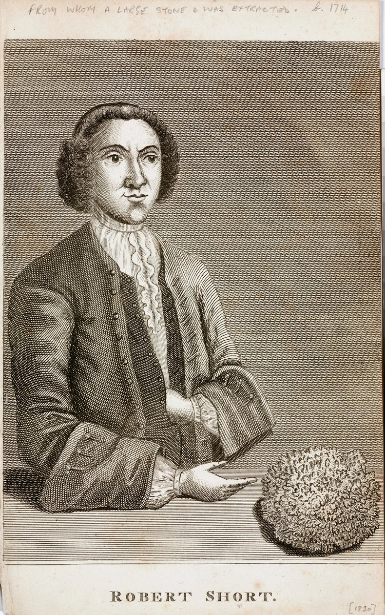 Robert Short, medical curiosity by Unbekannt