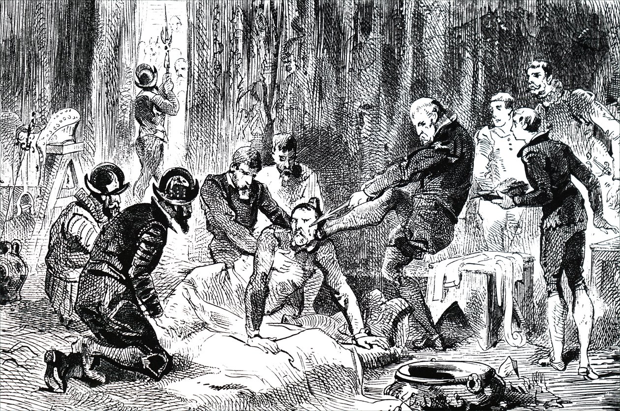 Ambroise Pare Removing a Lance from the Face of the Duc de Guise by Unbekannt