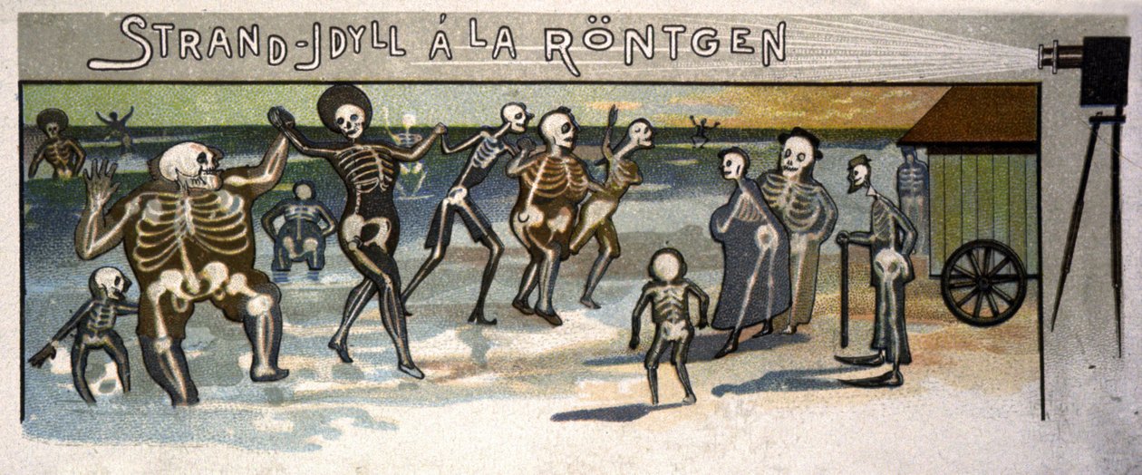 Beach Idyll at the Rontgen by Unbekannter Künstler