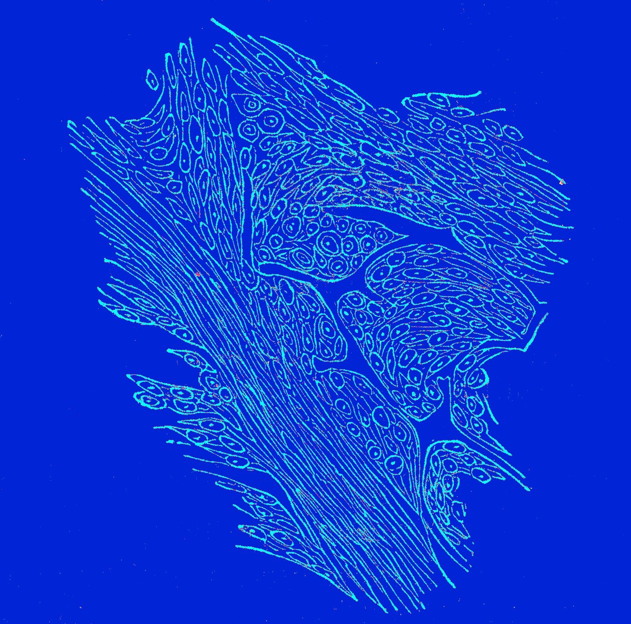 Crossing section of fibro-nucleated tumors by Unbekannter Künstler