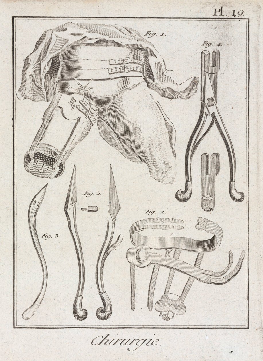 Early-Modern Orthopaedic surgery by Unbekannt