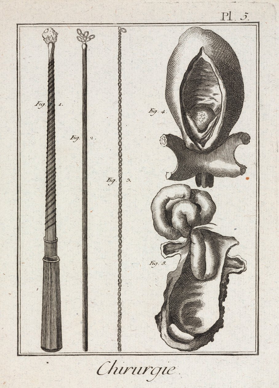 Early-Modern Surgical Instruments and Diagrams of Body Parts by Unbekannt