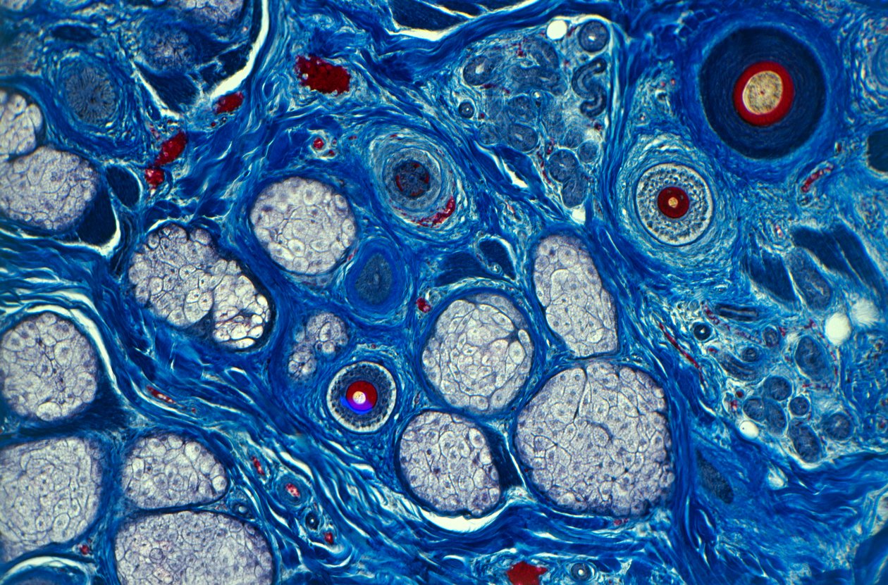 Human skin seen under a microscope, showing hair shaft and sweat pores ©Spike Walker (Microworld Services)/Dorling Kindersley/UIG/Leemage by Unbekannt
