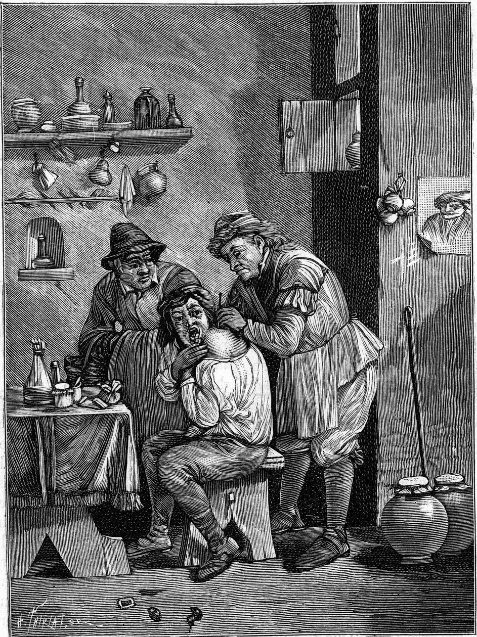 A charlatan surgeon in the 18th century examining a shoulder injury by Unknown artist