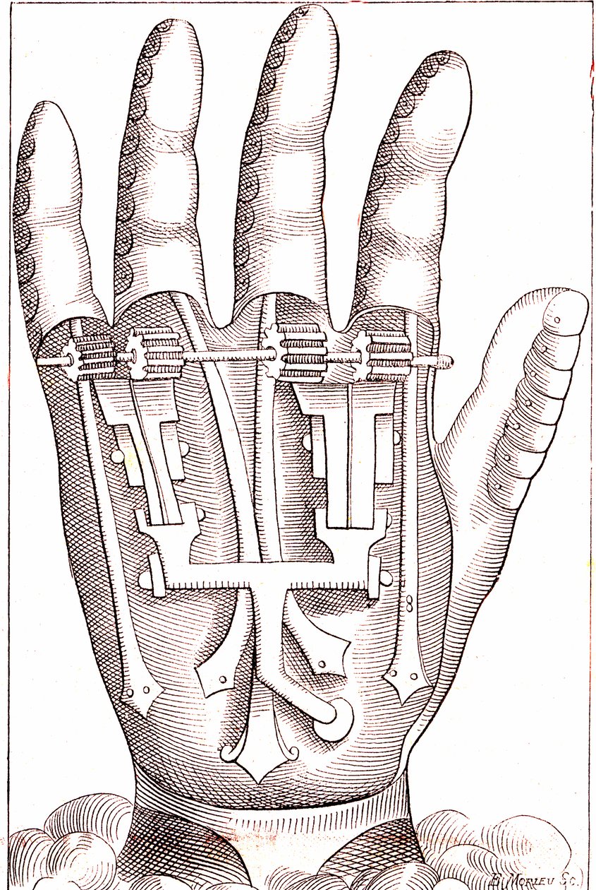 Artificial Hand Prosthesis by the French Surgeon Anatomist Ambroise Paré by Unknown artist