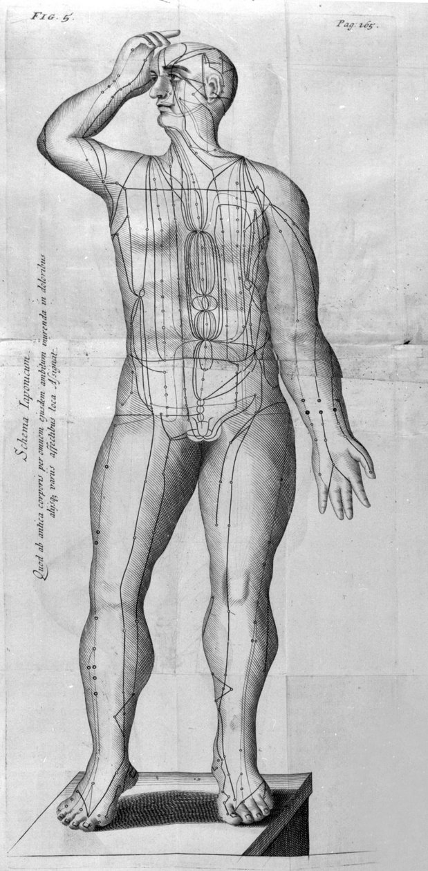 De Acupunctura by W. Ten Rhijne. London 1683. First Western text dealing with Acupuncture by Unknown artist