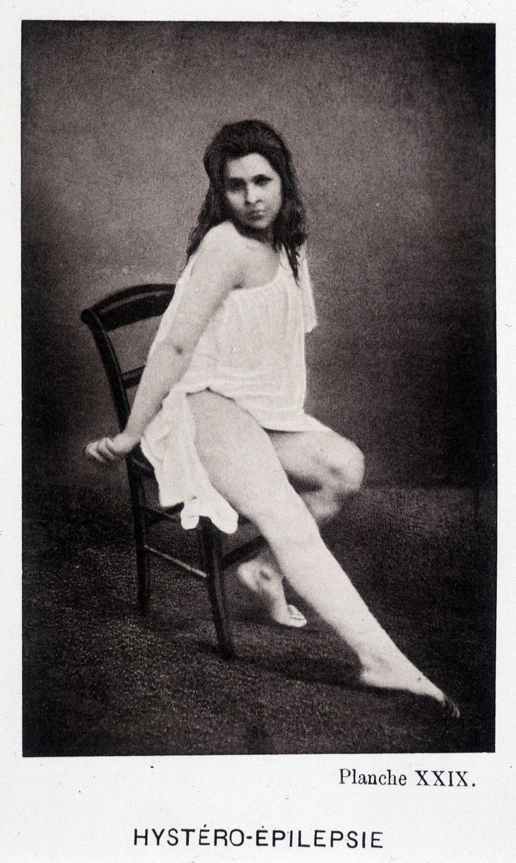Hystero Epilepsie - Contracture in “Photographic iconography of the Salpêtrière: service of Mr. Charcot” by Paul Regnard and Bourneville by Unknown artist