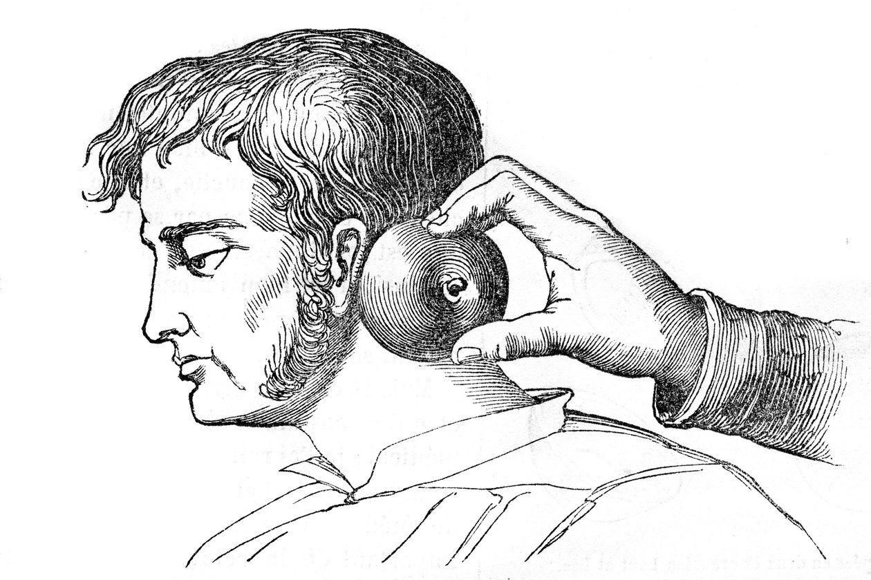 Local bleeding - application of leeches with an apple - engraving in 