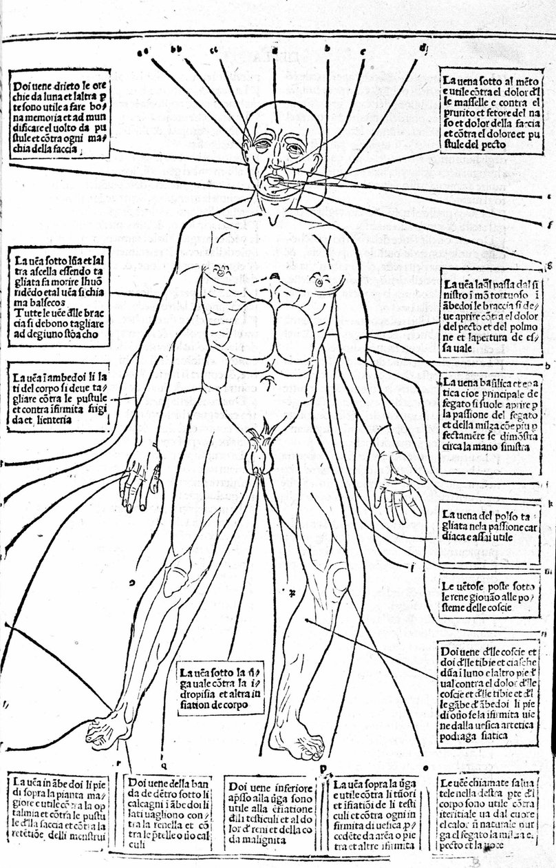 This picture shows the places of the body or practice bleeding depending on the pain. Treatise of Medicine by Gerolamo Cardano, Florence by Unknown artist