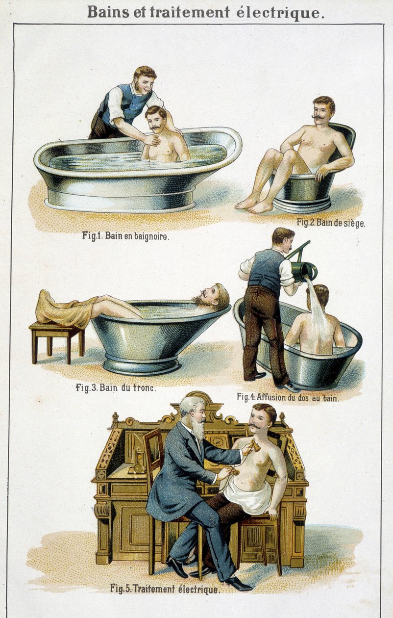 Baths and electric treatment: 1) Bathtub, 2) Seat bath, 3) Trunk bath, 4) Back to bath, 5) Electric treatment in 
