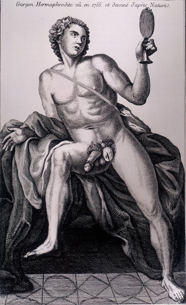 Hermaphrodite Boy Seen in 1755 and Drawn from Nature by Unknown artist