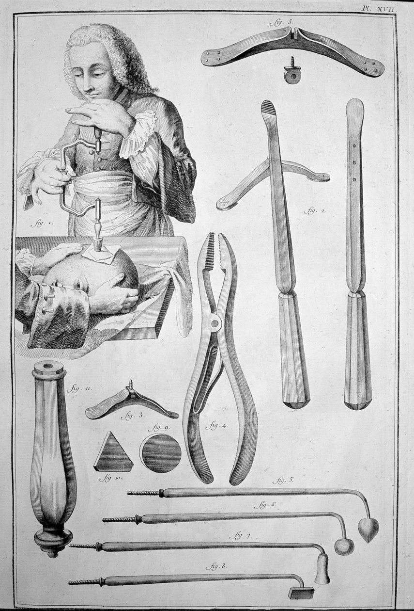 Trepanation of the Skull, Various Instruments by Unknown artist
