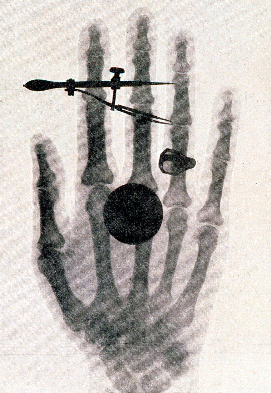 Wilhelm Roentgen