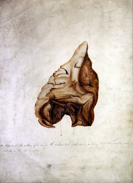 Study of Brain I, c.1850 by William Lover
