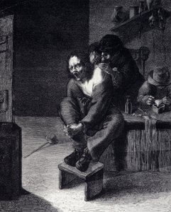 The surgical operation. Engraving after a painting by Adrien Brauwer. 17th century by Adriaen (after) Brouwer