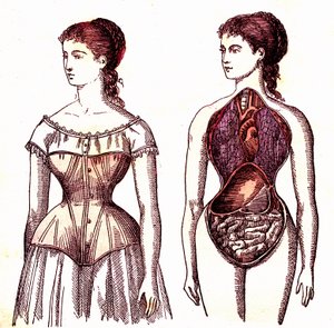 Corset Compression - Normal Life and Health by J. Rengade by Alphonse Demarle