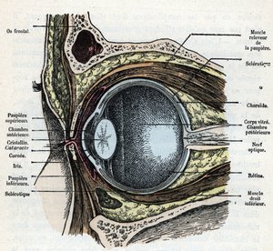 Vertical cut of an eyeball with cataract Engraving from 