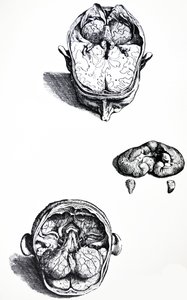 The Plates from the Seventh Book of the De Humani Corporis Fabrica