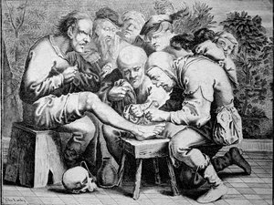 Ankle surgery (engraving)