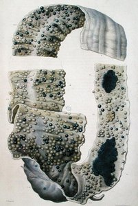 Diseases of the Intestines, from 