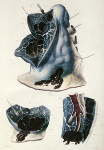 Diseases of the Lungs, from 