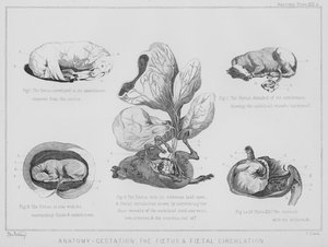 Anatomy, Gestation, the Fetus and Fetal Circulation