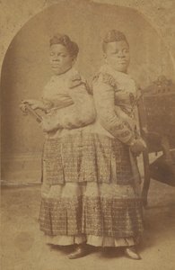 Albumen Print of Millie and Christine McCoy by Charles Eisenmann