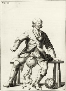 Draining fluid from a Hydrocele of the Scrotum, from Exercitationes Practicae circa Medendi Methodum by Frederik Dekkers, 1694 by Dutch School