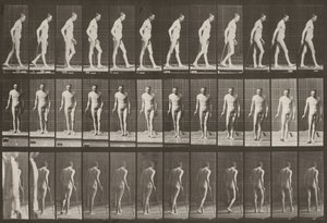 Plate Number 559. Partial Paraplegia, Walking with Cane by Eadweard Muybridge