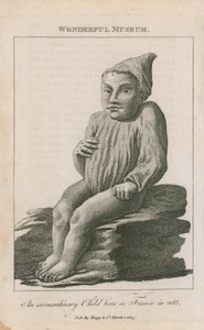 An Extraordinary Child Born in France in 1683