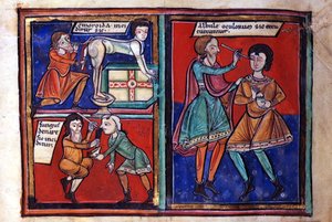 Sloane Ms 1975 fol.93 Medical operations