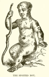The Spotted Boy by English School