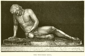 The Wounded Gaul