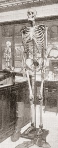 The Skeletons of Charles Byrne by English School