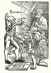 Amputation in the sixteenth century by European School