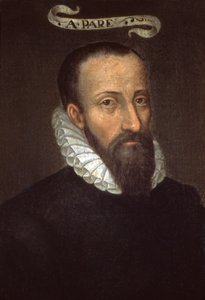 Ambroise Pare
