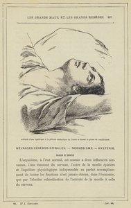 Attitude of a Hysterical Person in the Cataleptic Stage of the Attack and During the Crucifixion Phase