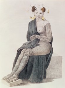 Congenital Ichthyosis, from a Book by G.M. Olbers, 1830